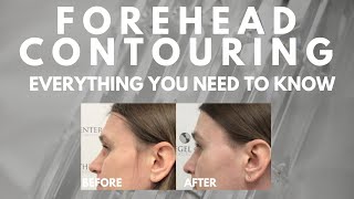 Everything You Need to Know About Forehead Contouring - FFS Surgeon Explains!