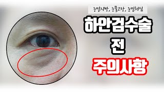 하안검수술을 받기 전 주의사항