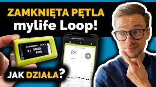 Poziom cukru we krwi kontrolowany automatycznie? | Pompa insulinowa Ypsopump i Dexcom G6 |Nie słodzę