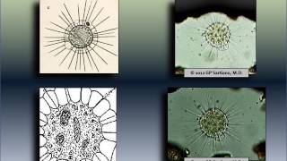 actinosphaerium   (multinucleated); WEV