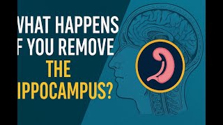 What Happens If You Remove the Hippocampus? | Henry Molaison’s Story
