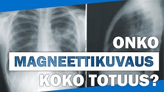 Magneettikuvaus - kuinka yleisiä poikkeavat löydökset ovat? Mitä magneettikuvat kertovat?