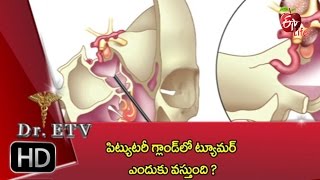 Dr ETV | Pituitary gland tumor treatment | 31st October 2016  డాక్టర్ ఈటివీ