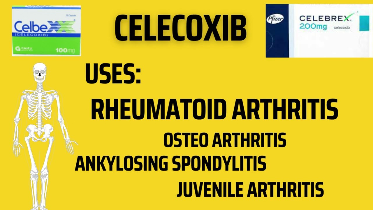 Celecoxib Uses, Side Effects | Celebrex | Celbex - YouTube