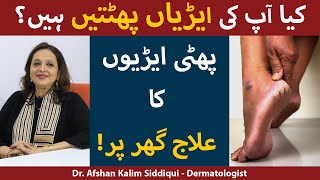 Phati Ariyan Tips In Urdu | Cracked Heels Treatment | Phati Heels Ka Ilaj | Cracked Heels Remedy