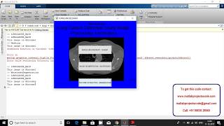 Lung Cancer Detection Using Image Processing Techniques