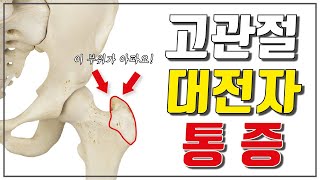 고관절 통증, 대전자 통증, 고관절 찝힘 원인과 4가지 해결법(골반통증, 고관절 전방 글라이드)