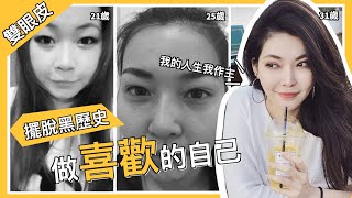 【雙眼皮手術】別人怎麼講你是他的事 只要做你喜歡的樣子就好！｜美加健康醫美集團