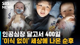 인공심장 달고서 400일…'이식 없이' 세상에 나온 순후 / SBS