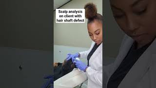 Trichoscopy to detect hair and scalp issues. www.tricrehairlosssolutions.com