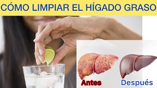 CÓMO Limpiar el Hígado Graso naturalmente | 5 pasos para el Tratamiento Eficiente del Hígado Graso