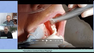 Dr. Tom’s Tips – Extracting 1st Molars with Isolite®