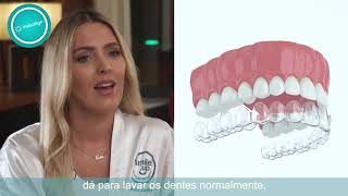 Ortodontia Invisível - Invisalign - Cátia Cunha | Smile.up Clínicas Dentárias