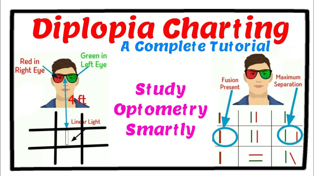 Diplopia Charting - A Complete Tutorial. - YouTube