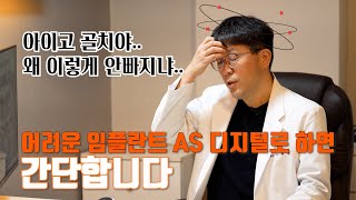 어려운 임플란트 AS 디지털로 하면 간단합니다.