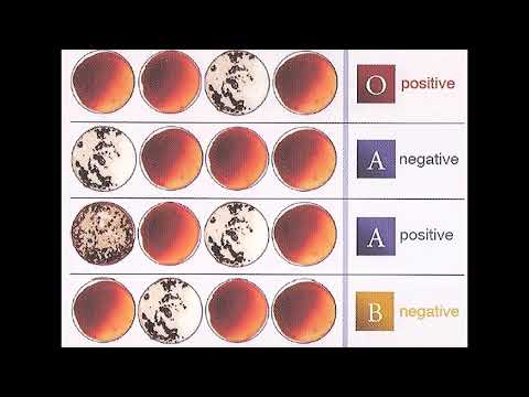 What limitations to suspect identification does using blood type have?