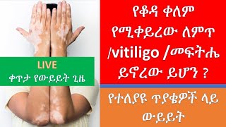 የቆዳ ቀለም የሚቀይረው ለምጥ መፍትሄ ይኖረው ይሆን ?/Vitiligo Treatment