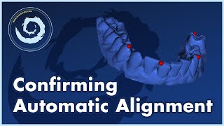 BSPV4.13: Confirming Automatic Model to CT Alignment for Accurate Implant Placement