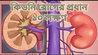 কিডনি রোগের প্রধান ১০ লক্ষণ, যা সবার জানা প্রয়োজন।