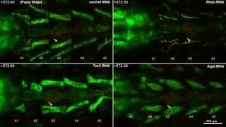 Time-lapse microscopy of muscle remodeling in Drosophila metamorphosis.