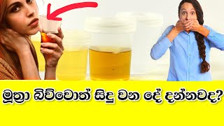 මූත්‍රා බිව්වොත් සිදු වන දේ දන්නවද? | What happens if you drink your urine?| Shiraj momad