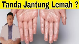 Apakah telapak tangan basah menandakan jantung lemah ?