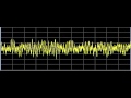 stomach disorders rife frequencies