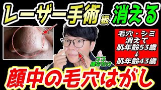 【毛穴・シミ解消して53歳⇨43歳✨】ガチガチの顔の筋肉をふにゃふにゃにして毛穴解消！顔のシミ、ほうれい線、マリオネットライン、ゴルゴラインも解消！首コリ・肩こり・頭痛も消える！