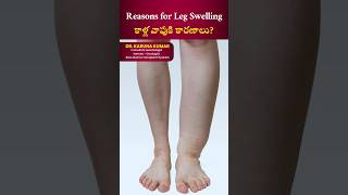 Reasons for Leg Swelling|కాళ్ల వాపుకి కారణాలు?#legswelling #anemia #heartconditions #drkarunakumar