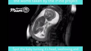 MRI Scan  of Baby Moving in Womb | Channel Mum