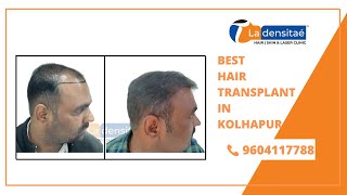 Best Hair Transplant in Kolhapur || Best Hair Transplant Clinic in Kolhapur