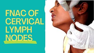 FNAC Of Cervical Lymph Nodes।।