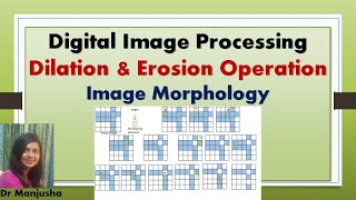 Dilation and Erosion, Opening and Closing : Image morphology