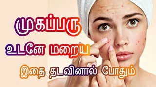 Cure Pimples Overnight in Tamil - முகப்பரு உடனே மறைய - Pimples treatment in Tamil- Tamil beauty Tips