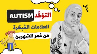 علامات التوحد المبكرة للرضع و الاطفال | Early signs for autism in babies