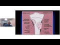 webinar radiological aspects of bone tumors by dr. james c. wittig