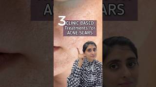 How to get rid of Acne Scars | Acne Scars Treatment | Acne Scars #shorts