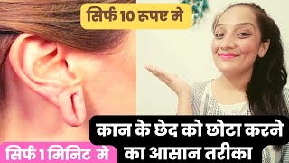 कान का छेद छोटा करने का आसान तरीका सिर्फ 10Rs मे || Ear Hole Repair Tip ||Indian mom & baby 🧿