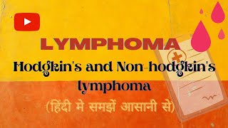 Lymphoma (लिम्फोमा): Hodgkin's and Non-hodgkin's lymhoma क्या होता है, इसके लक्षण तथा उपचार