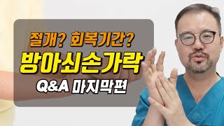 방아쇠손가락 절개? 회복기간? Q\u0026A 마지막편!! #방아쇠수지 #방아쇠손가락 #손가락통증 #손가락수술 #비절개수술