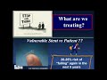 antiplatelet therapy post pci roxana mehran md