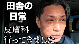 点状内出血が酷いので皮膚科に行ってきたら【田舎の日常Vlog】