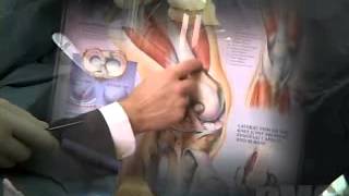 Knee Replacement Surgery   Detroit Medical Center