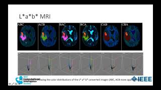 IEEE CIS Webinar: Intelligent Biomedical Image Analysis