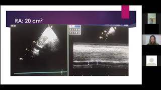 Webinar 1: Pulmonary Hypertension.