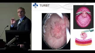 PRESENTATION: A brighter light at the end of the cystoscope - by Dr. Chris Morash