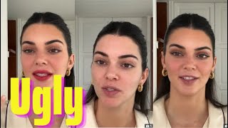 Kendall Jenner reveals her ugly skin with wrinkles and flaws after plastic surge