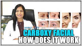 Carboxy Therapy Treatment | How Does It is Work? | Dr. Sudha Vani | Hybiz Doctor Talk