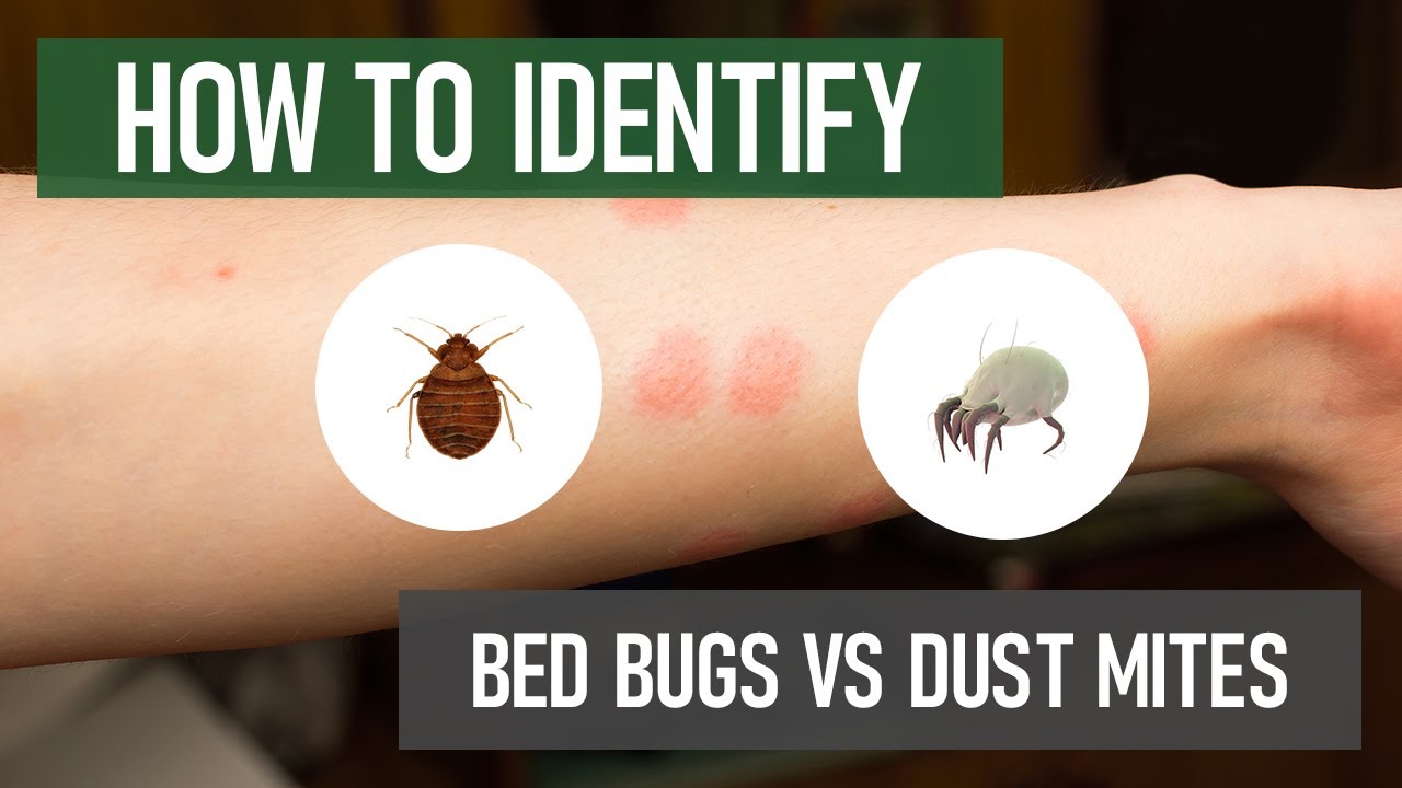 Dust Mites Bites Vs Bed Bugs Bites