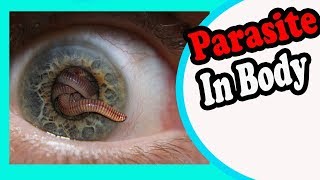 10 Signs And Symptoms Your Body is Full of Parasites